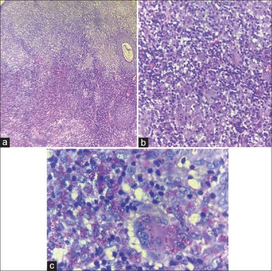 https://cdn.ncbi.nlm.nih.gov/pmc/blobs/048d/10810404/d4fa208a00e7/IDOJ-15-181-g003.jpg