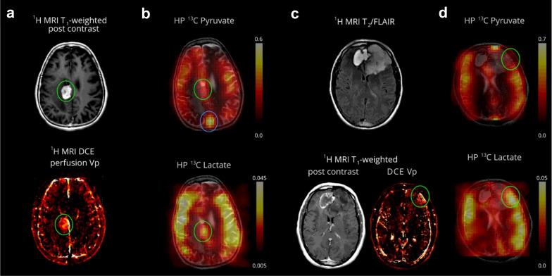 https://cdn.ncbi.nlm.nih.gov/pmc/blobs/0493/9385900/058c847f7361/13244_2022_1262_Fig4_HTML.jpg