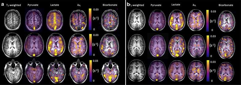https://cdn.ncbi.nlm.nih.gov/pmc/blobs/0493/9385900/a1a59f7aa958/13244_2022_1262_Fig3_HTML.jpg