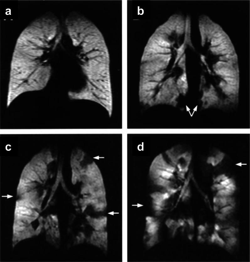 https://cdn.ncbi.nlm.nih.gov/pmc/blobs/0493/9385900/d01907f4820b/13244_2022_1262_Fig7_HTML.jpg