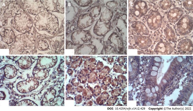 https://cdn.ncbi.nlm.nih.gov/pmc/blobs/0498/8891671/de544472bd29/WJH-14-429-g001.jpg