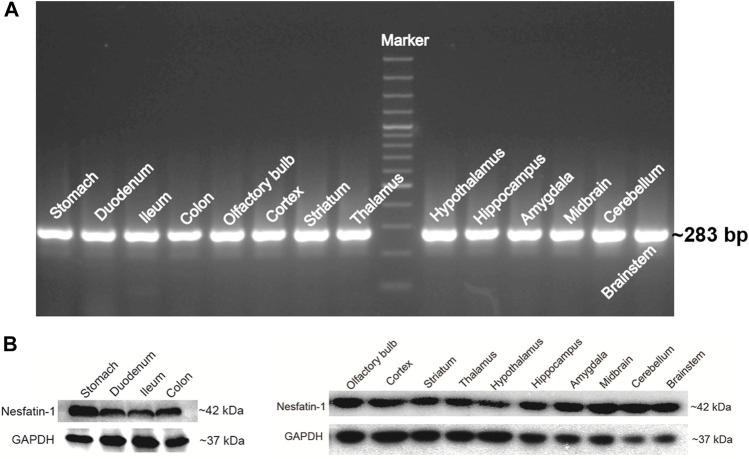 https://cdn.ncbi.nlm.nih.gov/pmc/blobs/0499/9019301/e658f7af7701/fphar-13-858522-g002.jpg