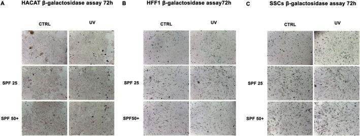 https://cdn.ncbi.nlm.nih.gov/pmc/blobs/049b/11968777/f240e375ef3a/JCMM-29-e70530-g005.jpg