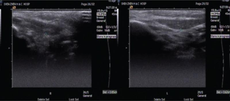https://cdn.ncbi.nlm.nih.gov/pmc/blobs/04a6/6426618/635ef02ba941/medi-98-e14794-g003.jpg