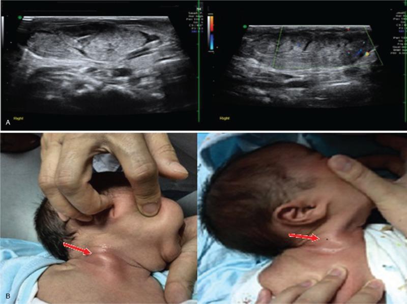 https://cdn.ncbi.nlm.nih.gov/pmc/blobs/04a6/6426618/c6c01c1d097e/medi-98-e14794-g006.jpg