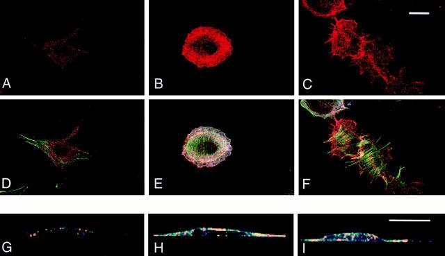 https://cdn.ncbi.nlm.nih.gov/pmc/blobs/04b6/2150672/9eb4b3e27570/JCB0005072.f4.jpg