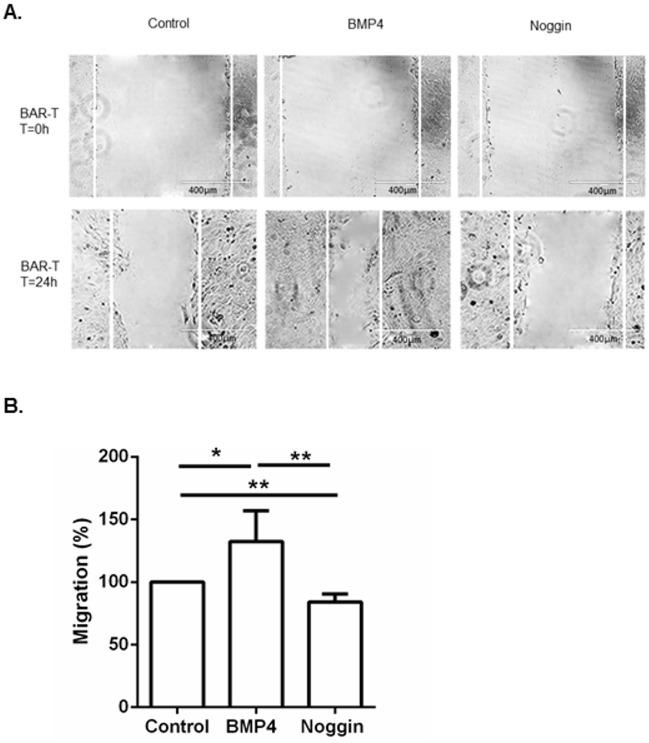 https://cdn.ncbi.nlm.nih.gov/pmc/blobs/04ba/4871520/895b5c1c782d/pone.0155754.g003.jpg