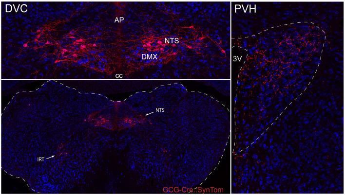 https://cdn.ncbi.nlm.nih.gov/pmc/blobs/04bb/7673779/8b573a9ad644/elife-59857-fig2-figsupp1.jpg