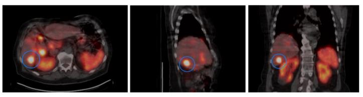 https://cdn.ncbi.nlm.nih.gov/pmc/blobs/04bc/8122794/e12cebb3d7db/cancers-13-02035-g002.jpg