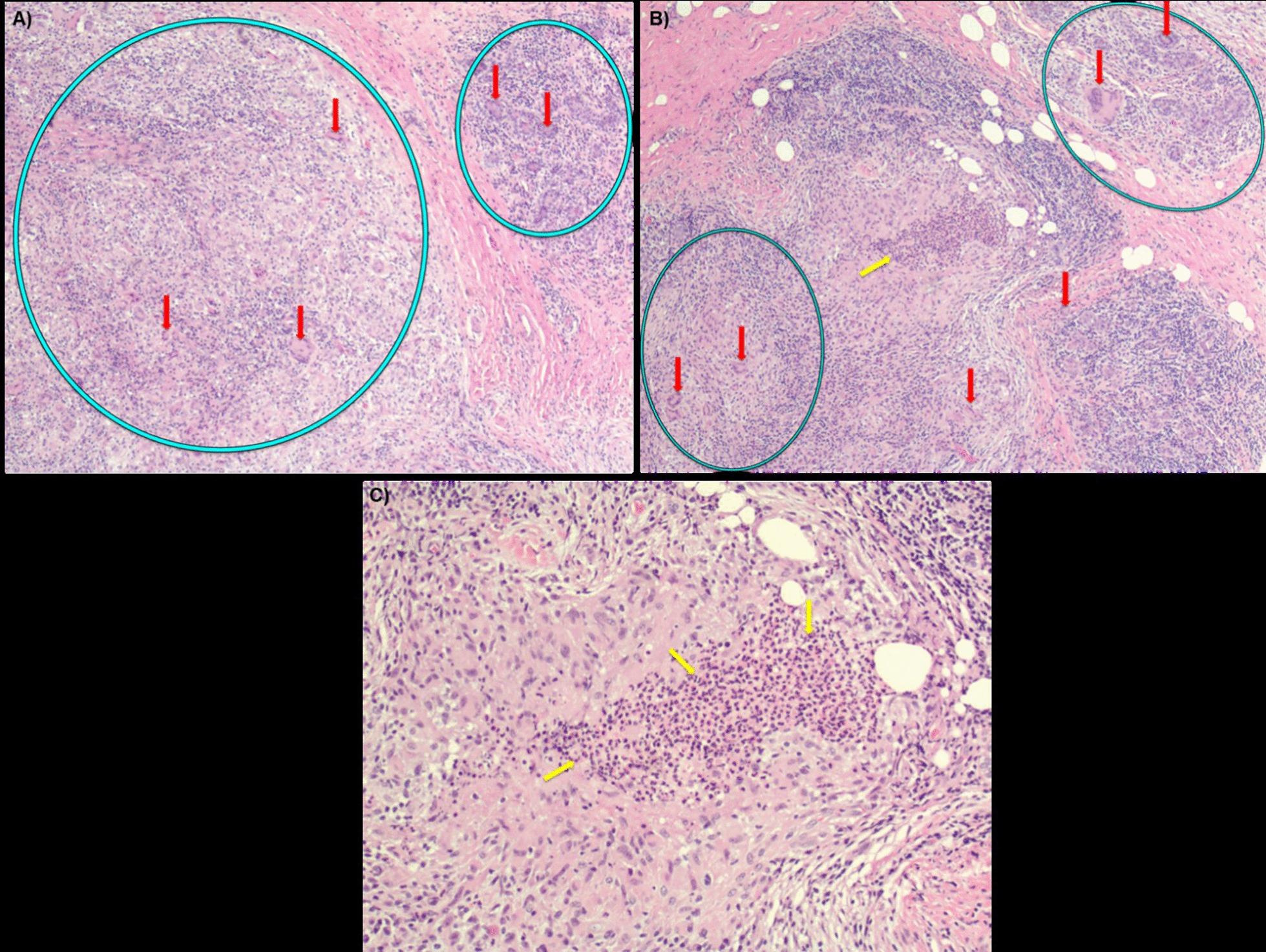 https://cdn.ncbi.nlm.nih.gov/pmc/blobs/04be/7654600/fc3d46ad1188/13256_2020_2563_Fig2_HTML.jpg