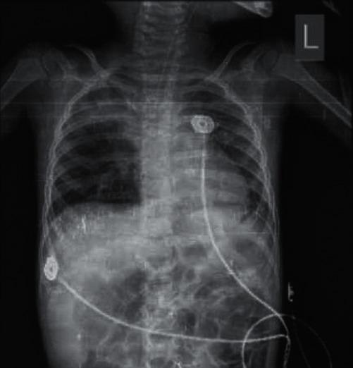 https://cdn.ncbi.nlm.nih.gov/pmc/blobs/04c7/7943265/632caedb650c/CRIPU2021-8877182.001.jpg