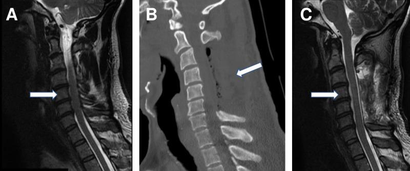 https://cdn.ncbi.nlm.nih.gov/pmc/blobs/04cc/6420335/1e6d8e70a0ab/cureus-0011-00000003878-i01.jpg