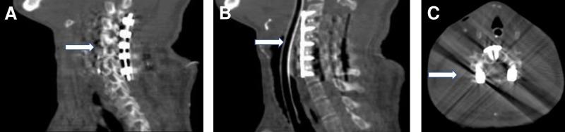 https://cdn.ncbi.nlm.nih.gov/pmc/blobs/04cc/6420335/8c1193bf69a0/cureus-0011-00000003878-i03.jpg