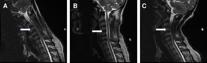https://cdn.ncbi.nlm.nih.gov/pmc/blobs/04cc/6420335/989558d65351/cureus-0011-00000003878-i02.jpg