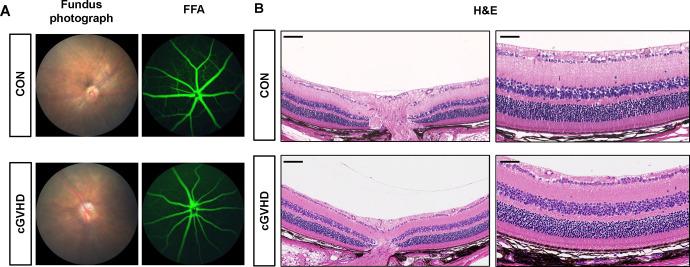 https://cdn.ncbi.nlm.nih.gov/pmc/blobs/04cd/11174147/dcd9b912fa65/iovs-65-6-20-f003.jpg