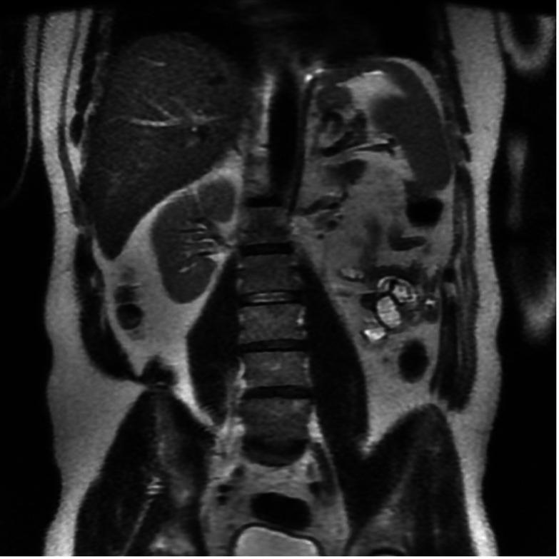 https://cdn.ncbi.nlm.nih.gov/pmc/blobs/04d3/12336565/7811485e68e5/egastro-3-3-g006.jpg