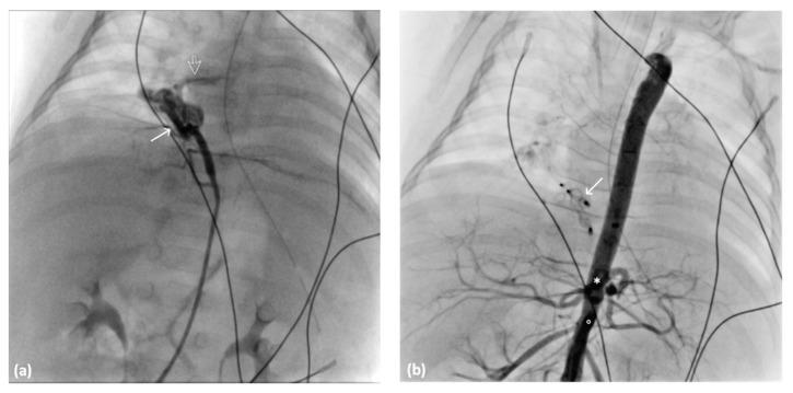 https://cdn.ncbi.nlm.nih.gov/pmc/blobs/04d4/10795894/cc8c07776330/diagnostics-14-00032-g006.jpg