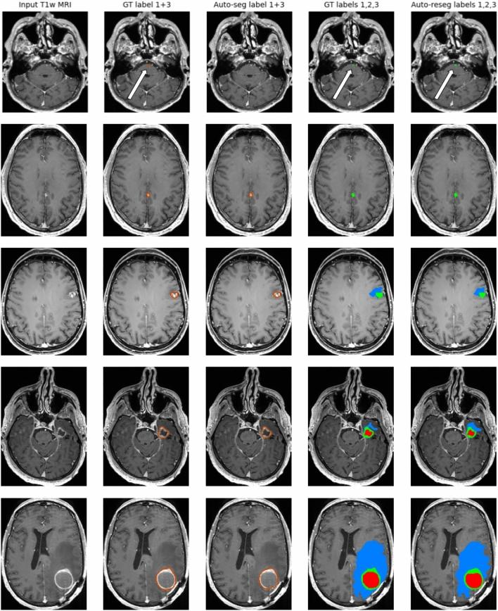 https://cdn.ncbi.nlm.nih.gov/pmc/blobs/04d8/11686181/00d4c871903b/41598_2024_78865_Fig2_HTML.jpg