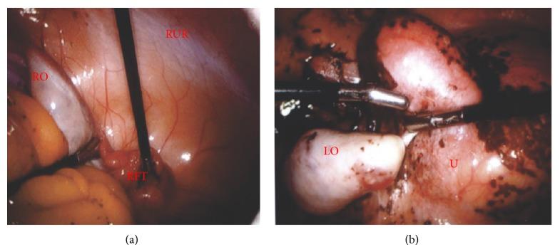 https://cdn.ncbi.nlm.nih.gov/pmc/blobs/04d9/4442265/63e5ec734f58/CRIOG2015-975463.002.jpg