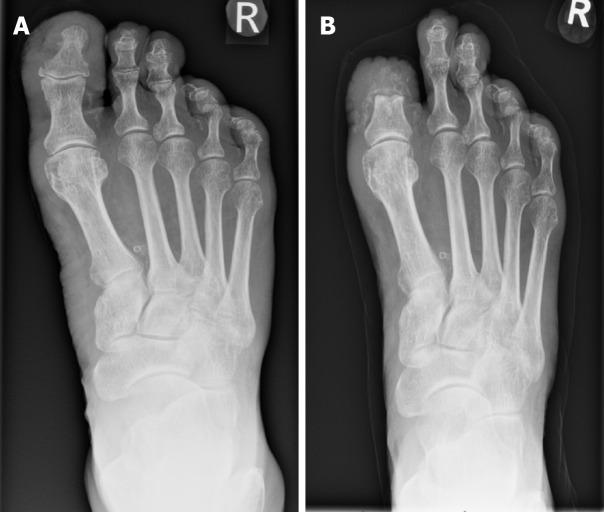 https://cdn.ncbi.nlm.nih.gov/pmc/blobs/04da/11145970/b2ab4659be35/WJO-15-404-g002.jpg