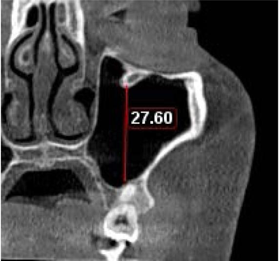 https://cdn.ncbi.nlm.nih.gov/pmc/blobs/04de/9807800/56894af7c684/isd-52-359-g004.jpg