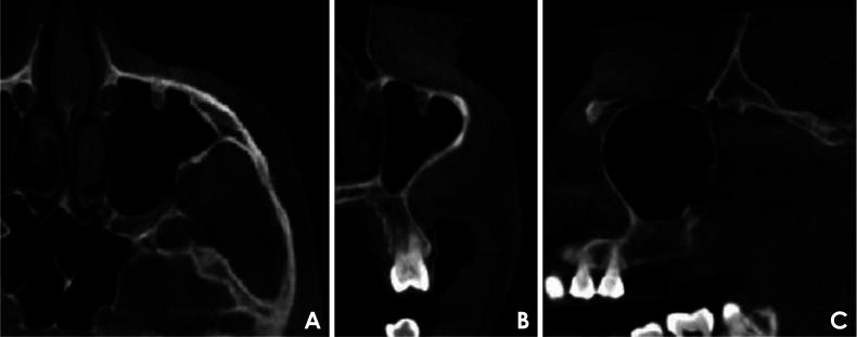 https://cdn.ncbi.nlm.nih.gov/pmc/blobs/04de/9807800/6dfa5bfddb55/isd-52-359-g001.jpg