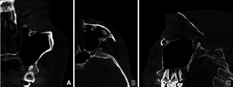 https://cdn.ncbi.nlm.nih.gov/pmc/blobs/04de/9807800/a87f6e529beb/isd-52-359-g002.jpg