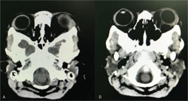 https://cdn.ncbi.nlm.nih.gov/pmc/blobs/04e2/7899863/326501e19da8/medi-100-e24693-g005.jpg