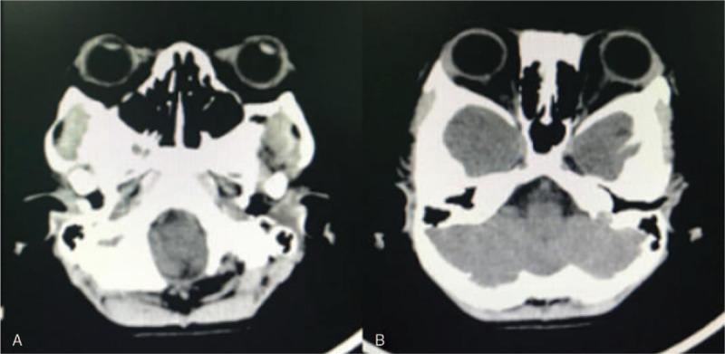 https://cdn.ncbi.nlm.nih.gov/pmc/blobs/04e2/7899863/b0dfed4a6aea/medi-100-e24693-g007.jpg