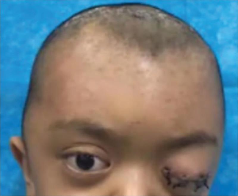 https://cdn.ncbi.nlm.nih.gov/pmc/blobs/04e2/7899863/bd03dc98bad0/medi-100-e24693-g004.jpg