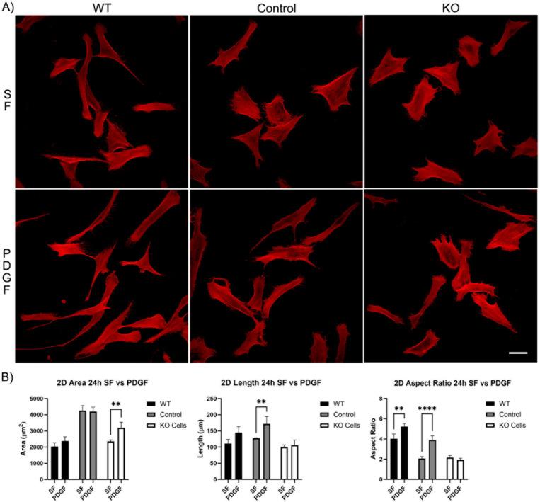 https://cdn.ncbi.nlm.nih.gov/pmc/blobs/04e5/11240817/d6eda5d58fa9/cells-13-01094-g003.jpg