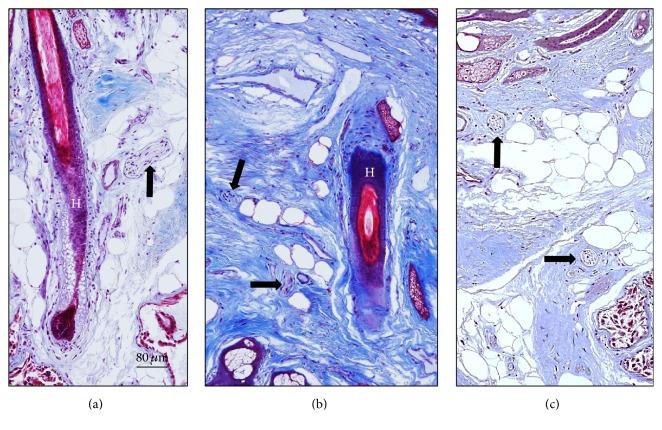 https://cdn.ncbi.nlm.nih.gov/pmc/blobs/04e8/5371220/8b658d68627a/BMRI2017-7830919.004.jpg