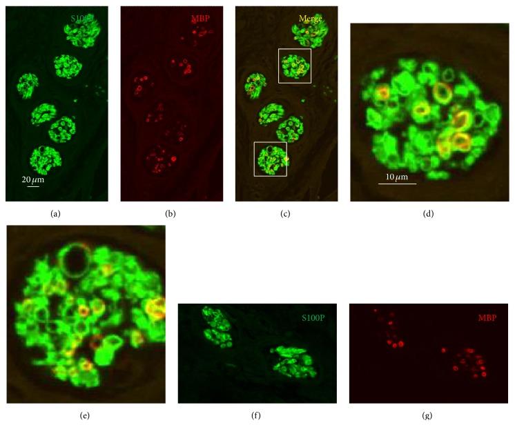 https://cdn.ncbi.nlm.nih.gov/pmc/blobs/04e8/5371220/db80f7baade2/BMRI2017-7830919.006.jpg