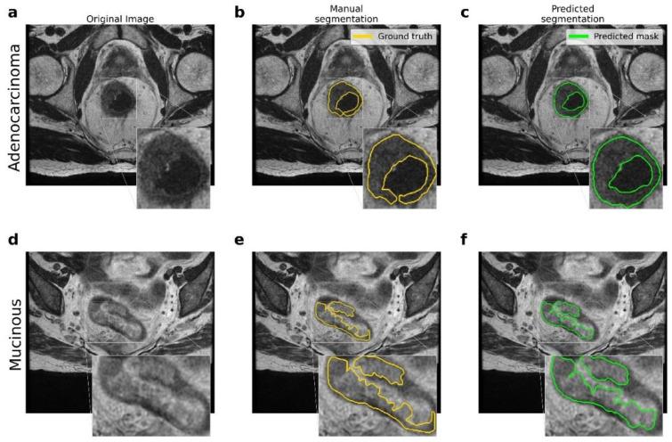 https://cdn.ncbi.nlm.nih.gov/pmc/blobs/04f4/9100060/3d8a457a2d3b/cancers-14-02231-g002.jpg
