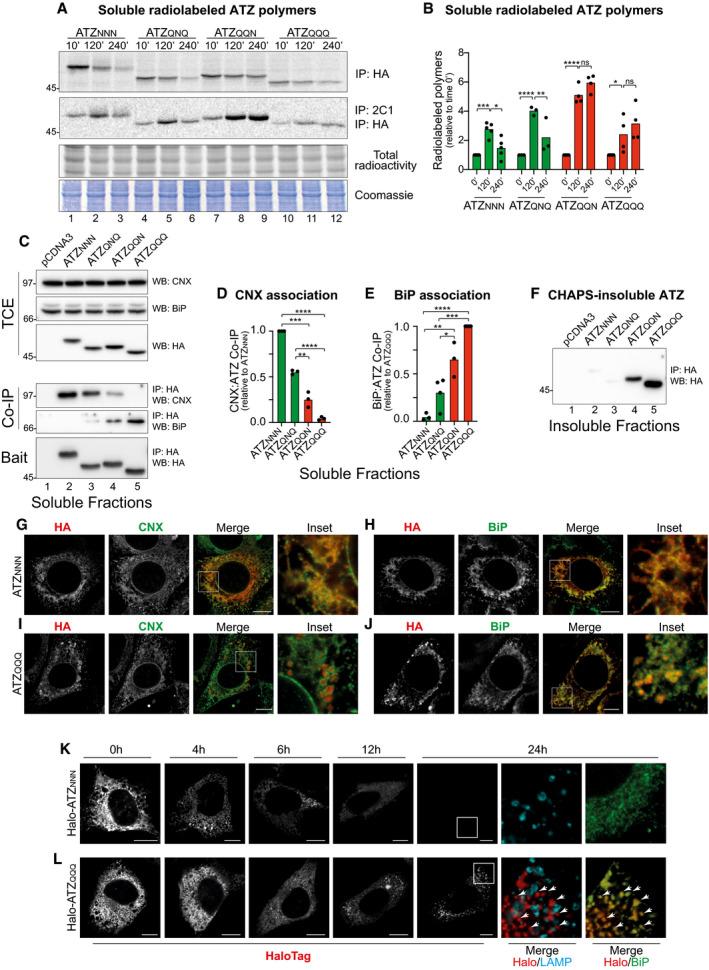 https://cdn.ncbi.nlm.nih.gov/pmc/blobs/04f9/8327951/ac81b8cc865e/EMBJ-40-e107240-g003.jpg