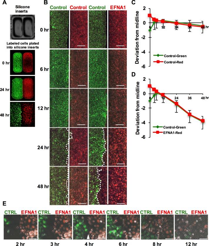 https://cdn.ncbi.nlm.nih.gov/pmc/blobs/04fb/5774870/6d3d51068eca/i1552-5783-59-1-393-f04.jpg