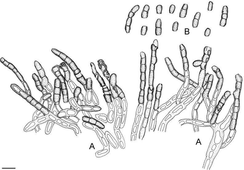 https://cdn.ncbi.nlm.nih.gov/pmc/blobs/04fe/7225685/0e68281576ff/fuse-2018-2-6-g047.jpg