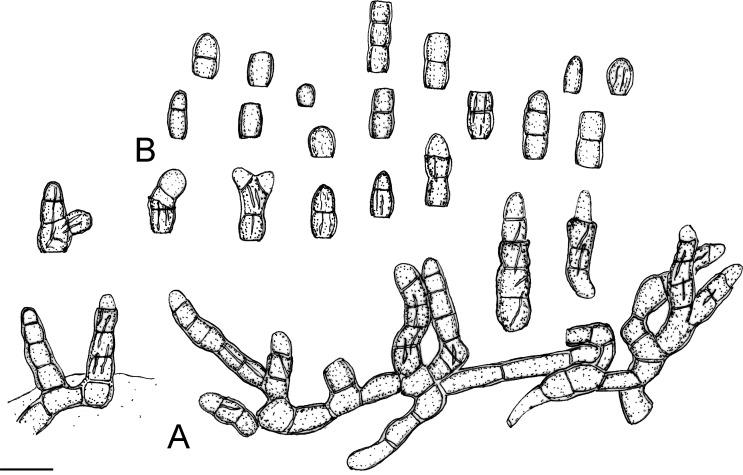 https://cdn.ncbi.nlm.nih.gov/pmc/blobs/04fe/7225685/1c695ee2ebe9/fuse-2018-2-6-g011.jpg