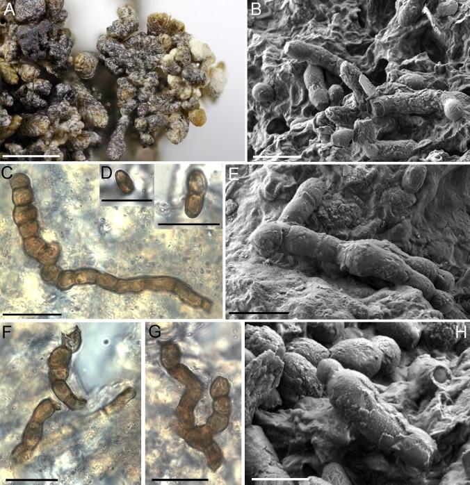 https://cdn.ncbi.nlm.nih.gov/pmc/blobs/04fe/7225685/7f9a63eee582/fuse-2018-2-6-g012.jpg