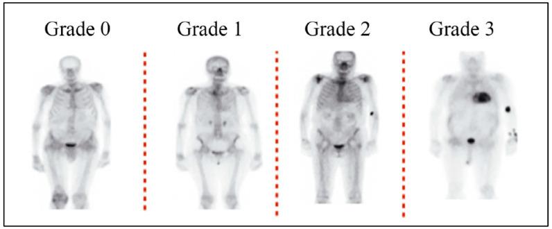 https://cdn.ncbi.nlm.nih.gov/pmc/blobs/0500/10814030/9006fcd5f8b2/diagnostics-14-00212-g002.jpg
