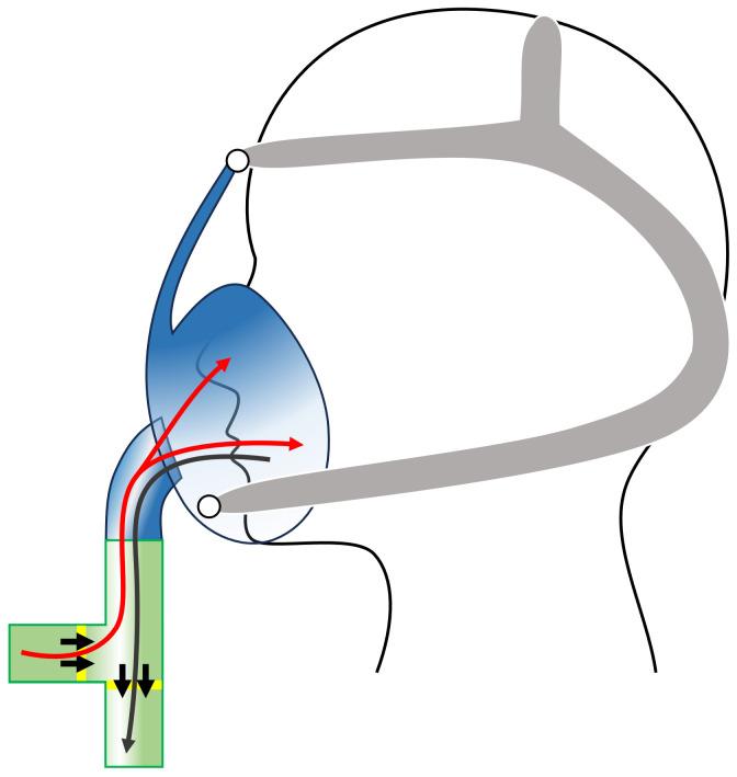 https://cdn.ncbi.nlm.nih.gov/pmc/blobs/0500/11154498/b9e4a7d98994/ijerph-21-00284-g002.jpg