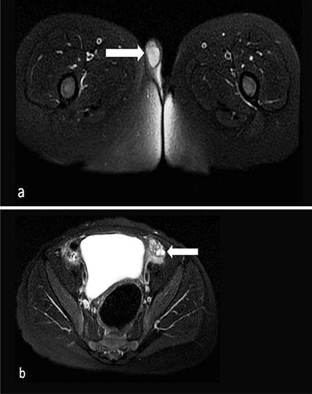 https://cdn.ncbi.nlm.nih.gov/pmc/blobs/0505/7499138/10d5afb90b1d/JCRPE-12-308-g3.jpg