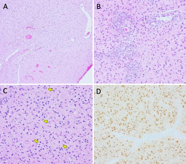 https://cdn.ncbi.nlm.nih.gov/pmc/blobs/050a/11912927/c36eaf3064ae/CASE24683_figure_1.jpg