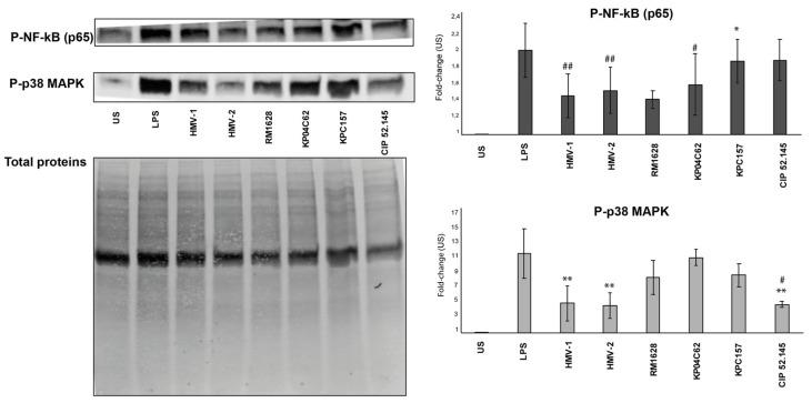 https://cdn.ncbi.nlm.nih.gov/pmc/blobs/0510/8877041/ebc54e8859a3/microorganisms-10-00384-g004.jpg