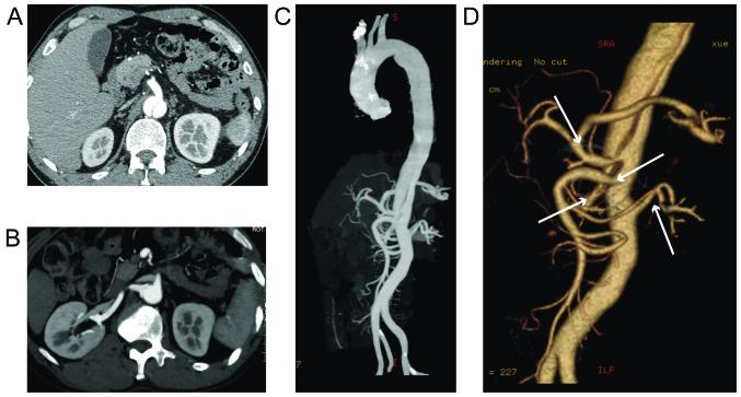 https://cdn.ncbi.nlm.nih.gov/pmc/blobs/0512/5348692/d59fab61736d/etm-13-02-0405-g03.jpg