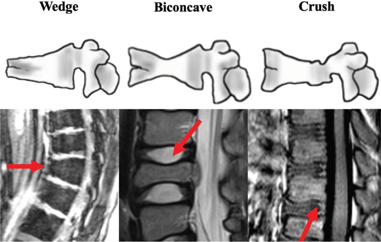 https://cdn.ncbi.nlm.nih.gov/pmc/blobs/051a/12088191/069d5104166f/gr1.jpg