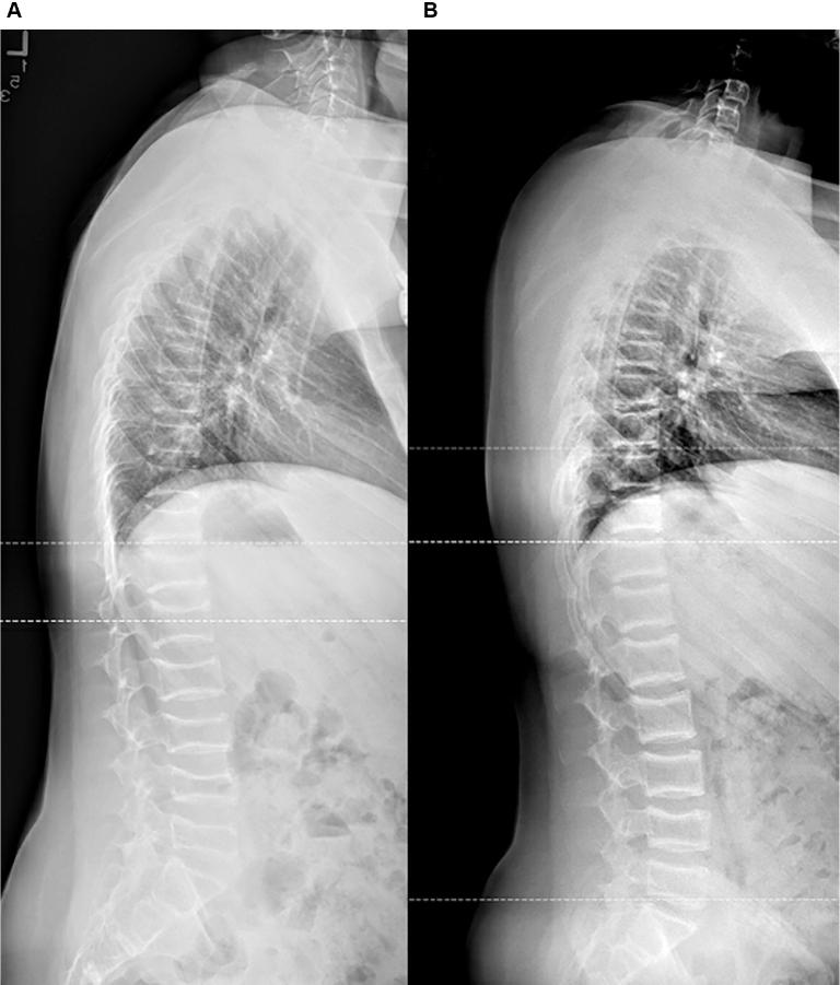 https://cdn.ncbi.nlm.nih.gov/pmc/blobs/051a/12088191/b0880cc1393f/gr3.jpg