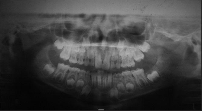 https://cdn.ncbi.nlm.nih.gov/pmc/blobs/052c/3883335/278d17ba169f/CCD-4-515-g003.jpg