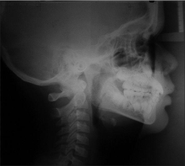 https://cdn.ncbi.nlm.nih.gov/pmc/blobs/052c/3883335/6d3b779ca712/CCD-4-515-g010.jpg