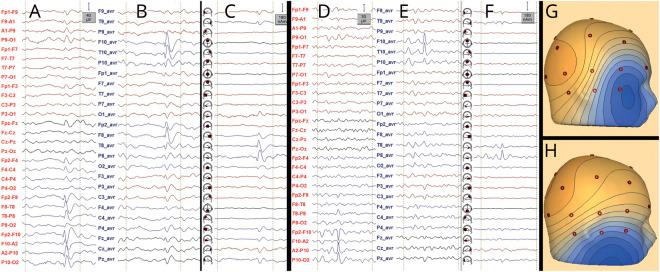 https://cdn.ncbi.nlm.nih.gov/pmc/blobs/0534/7526669/e0f1ee11b612/NEUROLOGY2019020164FF2.jpg